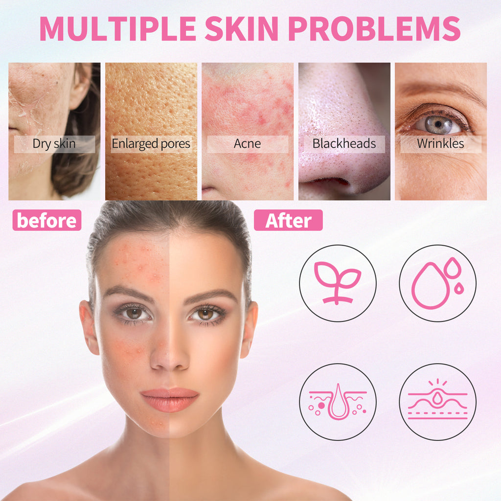5 Step Skincare Kit
