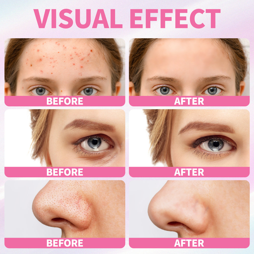 5 Step Skincare Kit