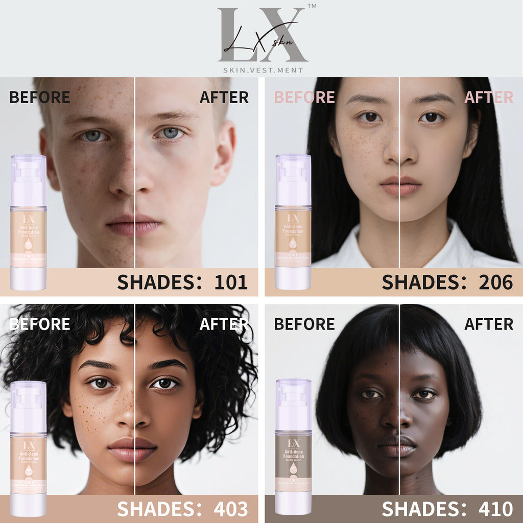 Anti-acne Foundation #403