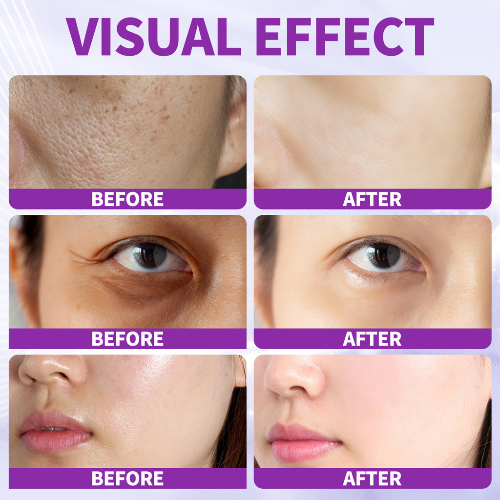 6 Step Skincare Set