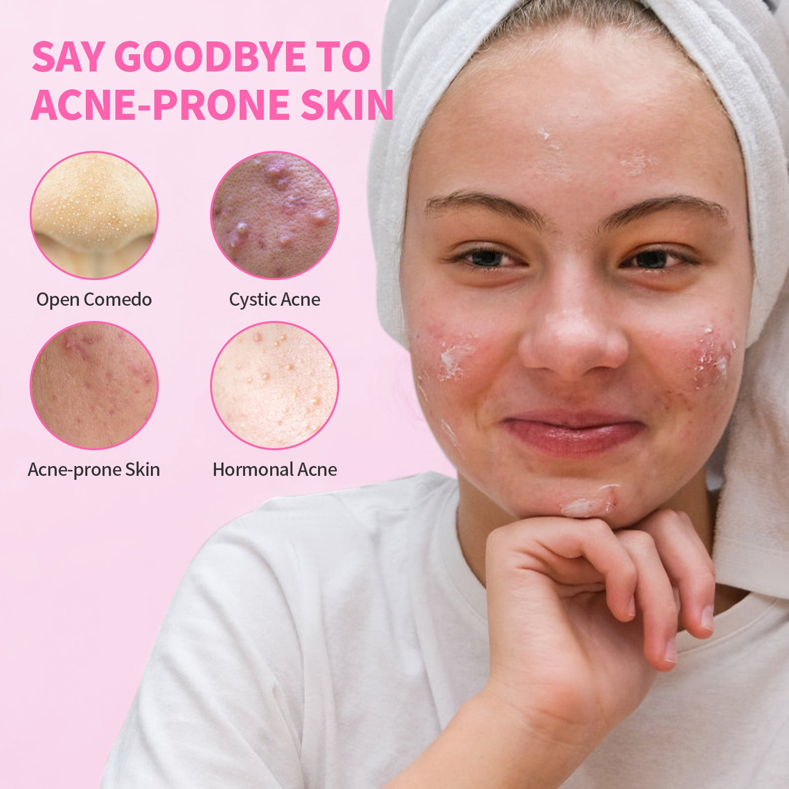 Precision Acne Spot Serum
